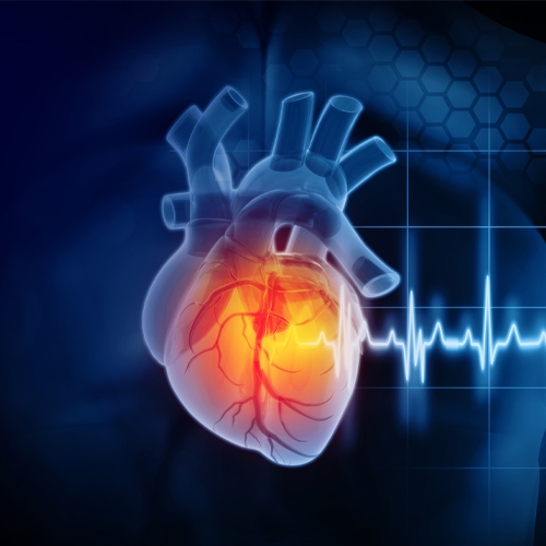 Cardiotoxicity Screening