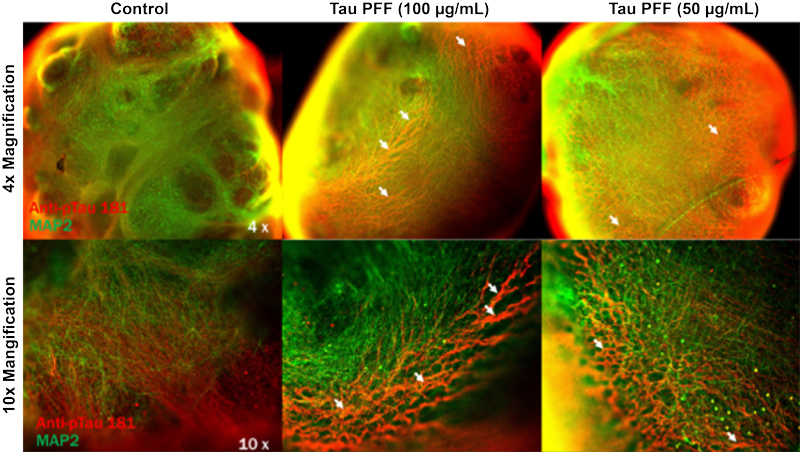 Alzheimer’s Disease Modeling