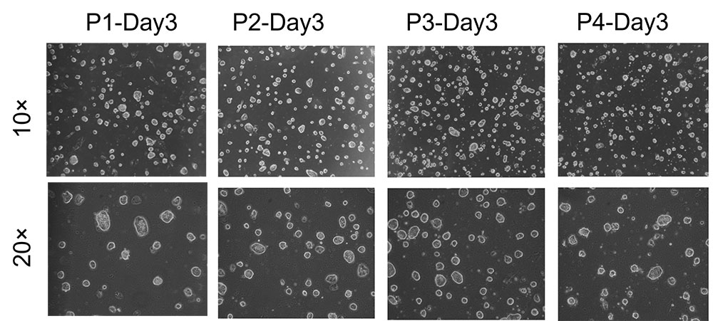 iPSC Culturing