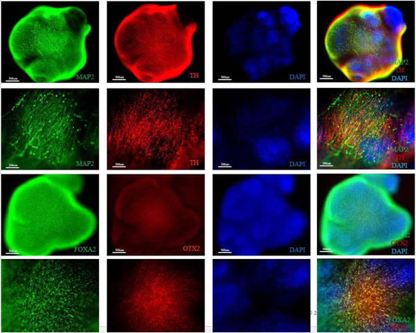 Marker Expression of Midbrain Organoids