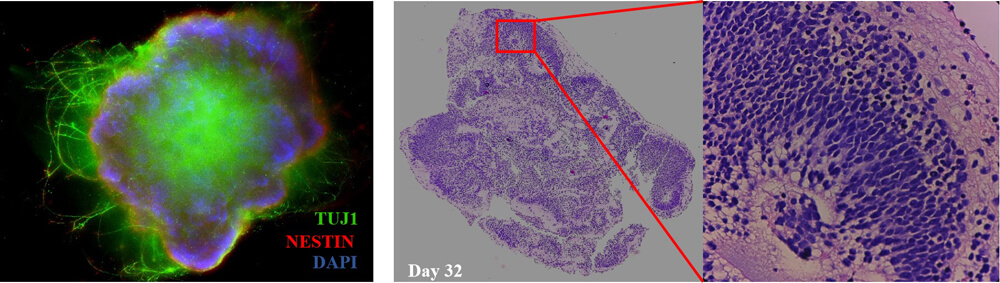  GDNF ORGANOID CULTURE