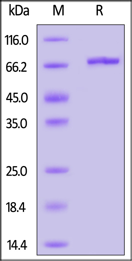 Alpha-fetoprotein SDS-PAGE