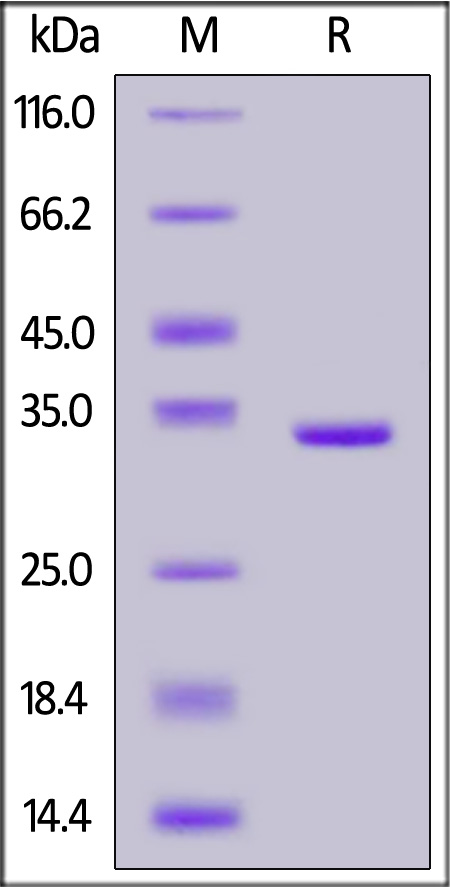 Human ANXA5, Tag Free (Cat. No. AN5-H5118) SDS-PAGE gel