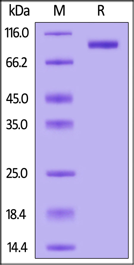 Human APLP2, His Tag (Cat. No. AP2-H52H9) SDS-PAGE gel