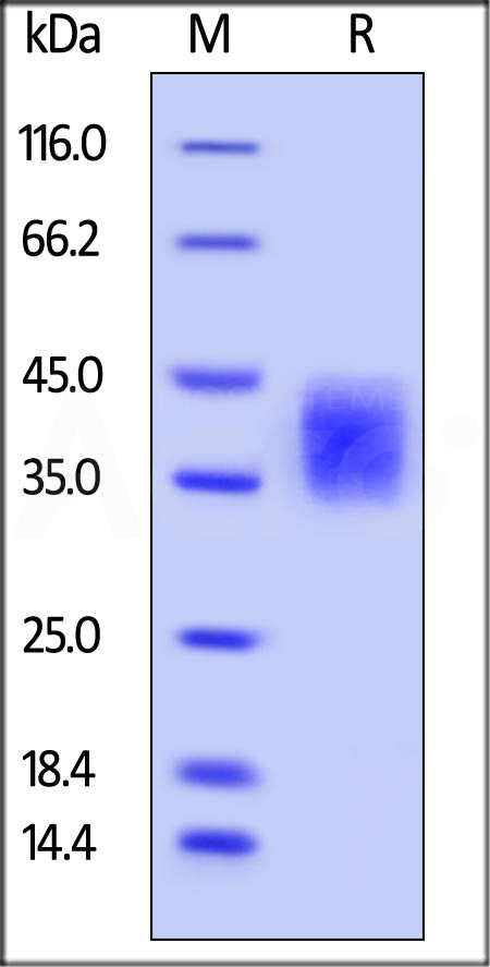 Mouse B7-H5, His Tag (Cat. No. B75-M52H7) SDS-PAGE gel