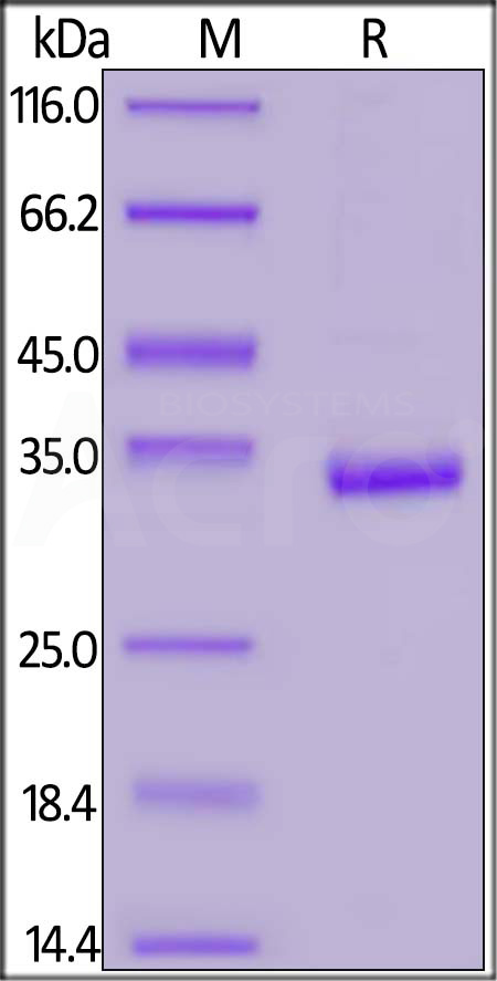 Carbonic Anhydrase IX SDS-PAGE