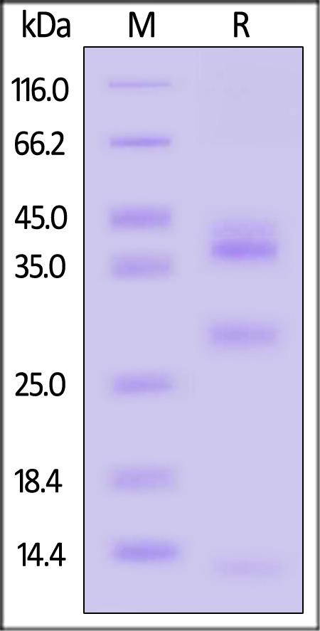 Cathepsin L SDS-PAGE