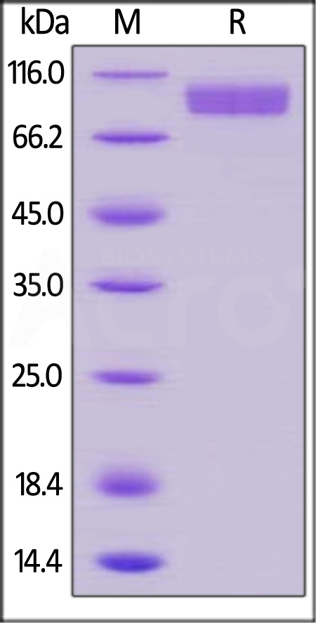 Human CD31, His Tag (Cat. No. CD1-H5224) SDS-PAGE gel