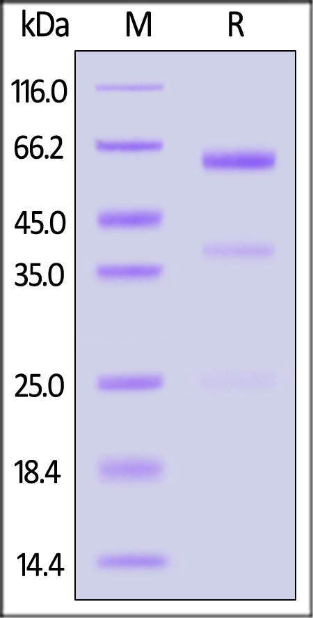 CD39L1/ENTPD2 SDS-PAGE