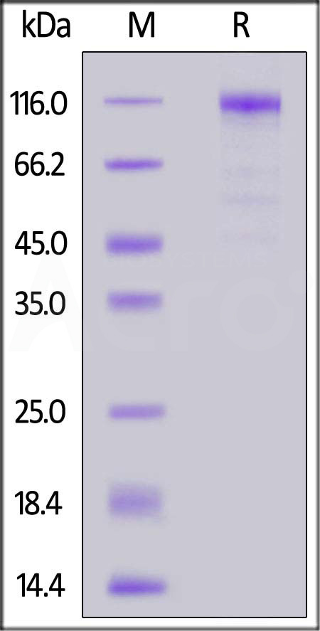 Canine Siglec-2, His Tag (Cat. No. CD2-C52H3) SDS-PAGE gel