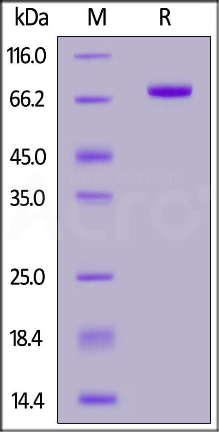 Human CD5, Fc Tag (Cat. No. CD5-H5253) SDS-PAGE gel