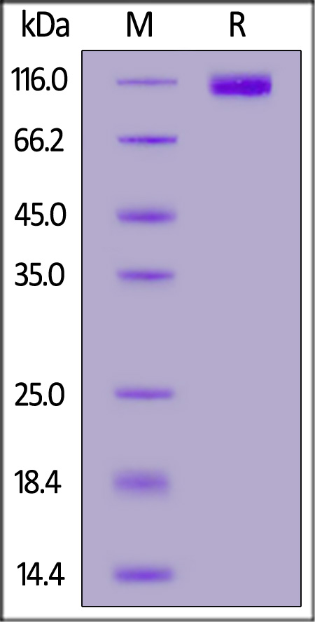 CD117 SDS-PAGE