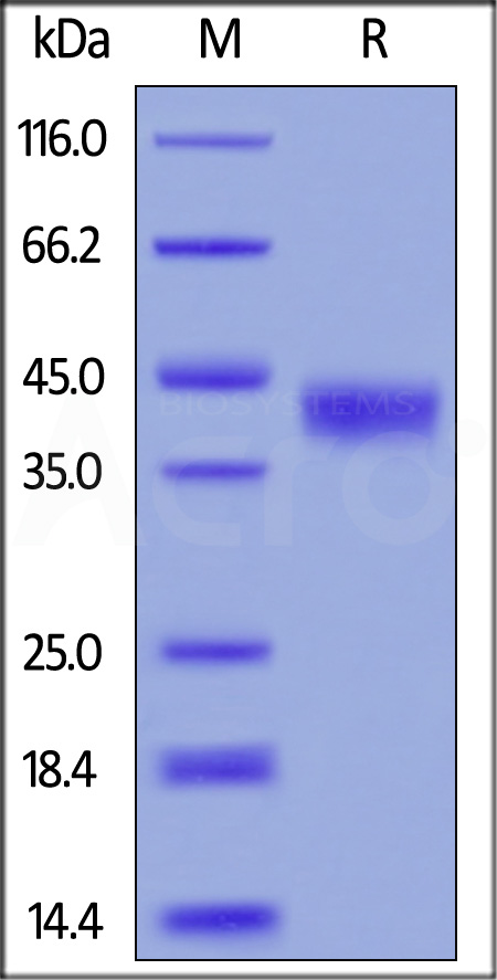 Mouse CD38, His Tag (Cat. No. CD8-M5223) SDS-PAGE gel