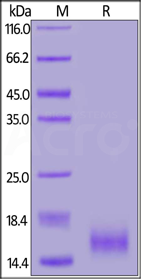 Human CD59, His Tag (Cat. No. CD9-H52H9) SDS-PAGE gel