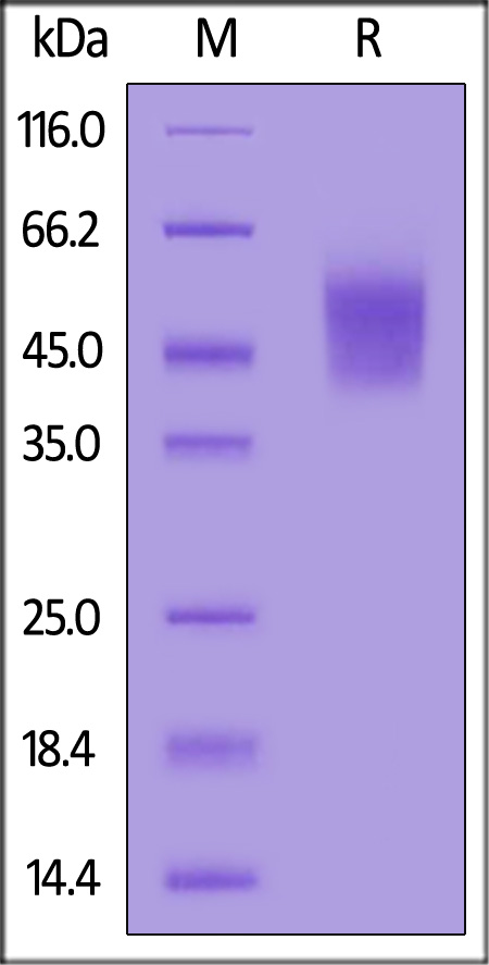 Rabbit CD19, His Tag (Cat. No. CD9-R52H3) SDS-PAGE gel