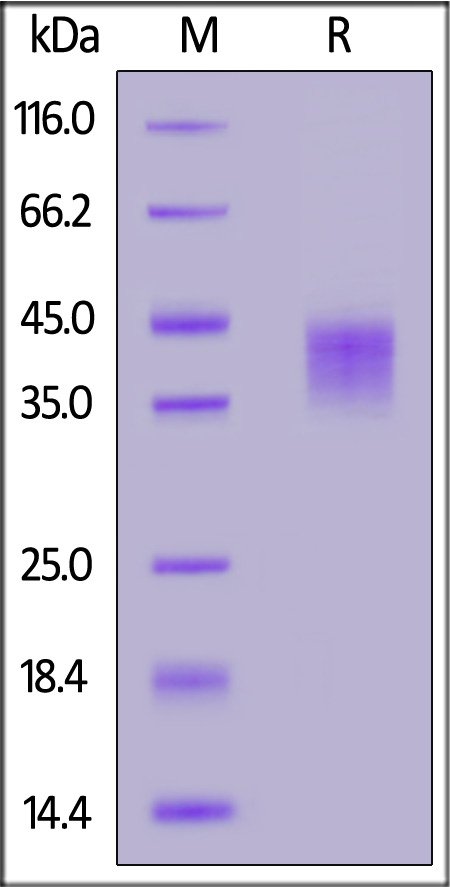 Human CD16a (F176, S197P) Protein, His Tag (Cat. No. CDA-H52H6) SDS-PAGE gel