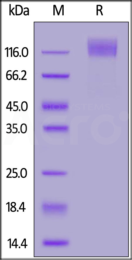 FITC-Labeled Human CEACAM-5, His Tag (Cat. No. CE5-HF254) SDS-PAGE gel