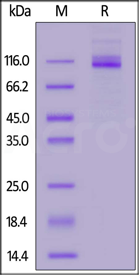 Mouse CEACAM-5, His Tag (Cat. No. CE5-M52H3) SDS-PAGE gel