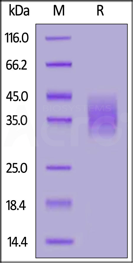 Rat CLEC12A, His Tag (Cat. No. CLA-R5248) SDS-PAGE gel