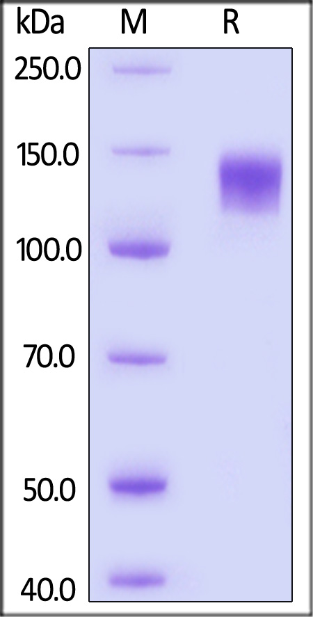 Glycoprotein B/gB (HCMV) SDS-PAGE