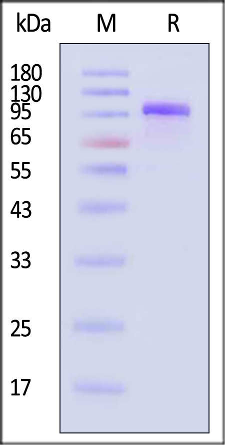 Complement C2 SDS-PAGE