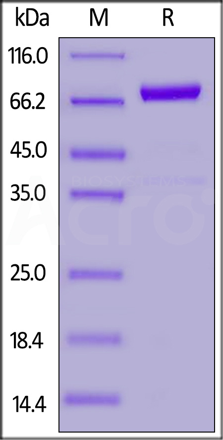 Dkk-1 SDS-PAGE