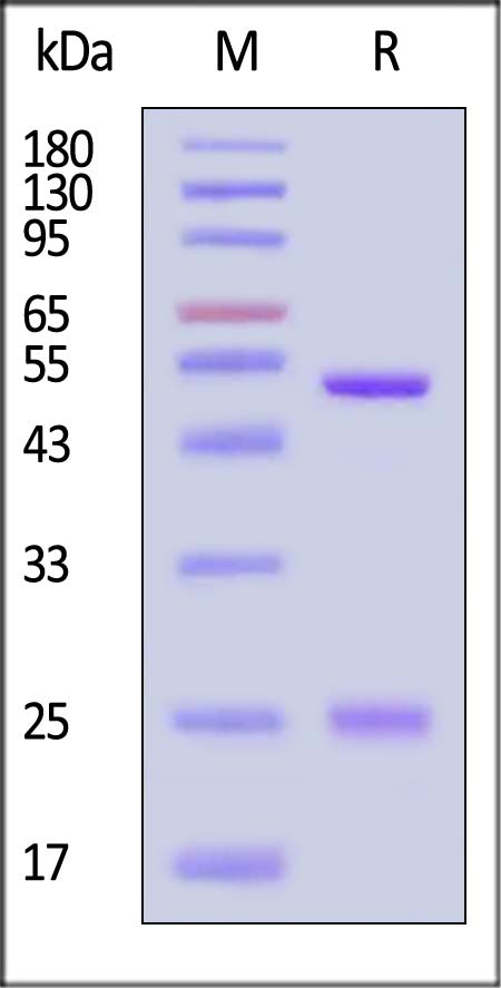 IgG control SDS-PAGE