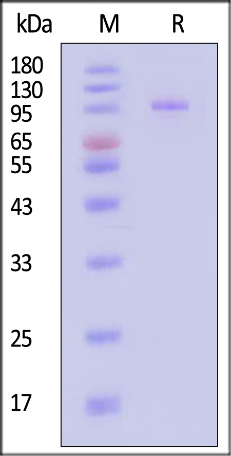 DPPIV SDS-PAGE