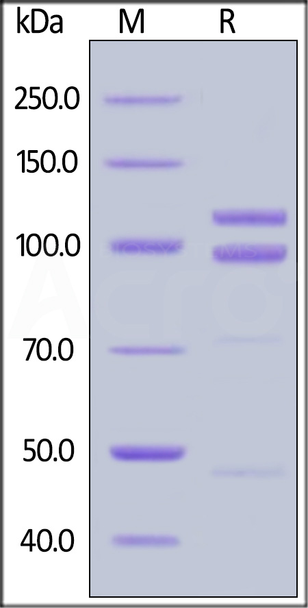 E-Cadherin SDS-PAGE