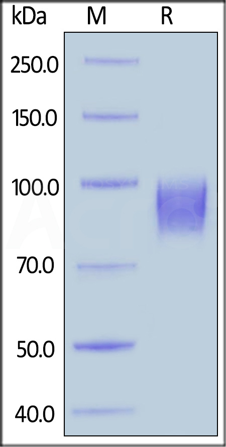 EGF R SDS-PAGE