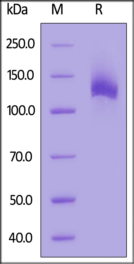 EGF R SDS-PAGE