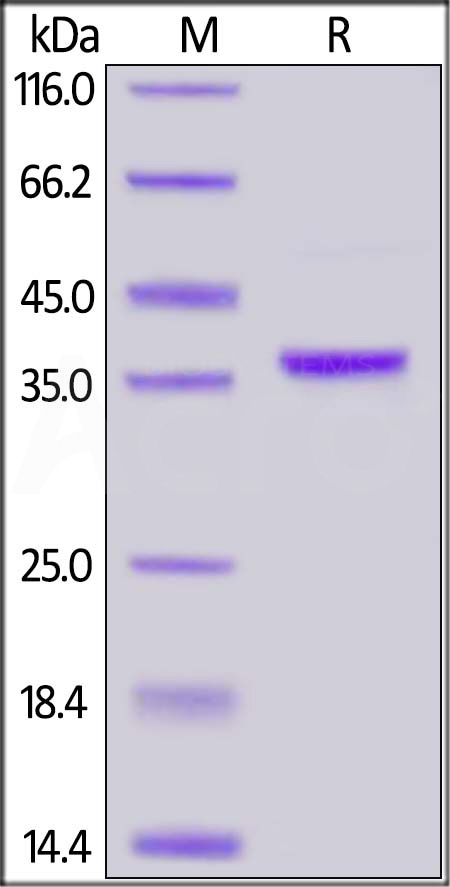 Human AIMP1, His Tag (Cat. No. EM2-H5142) SDS-PAGE gel