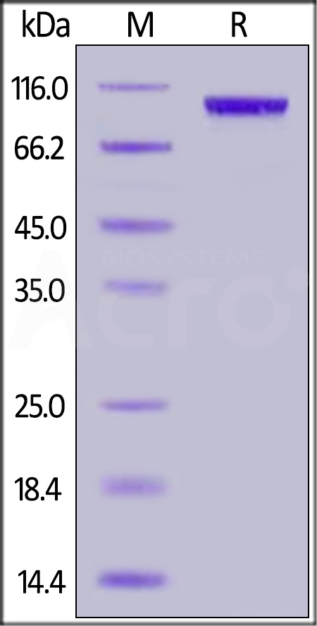 Human ENPP-2, His Tag (Cat. No. EN2-H5241) SDS-PAGE gel