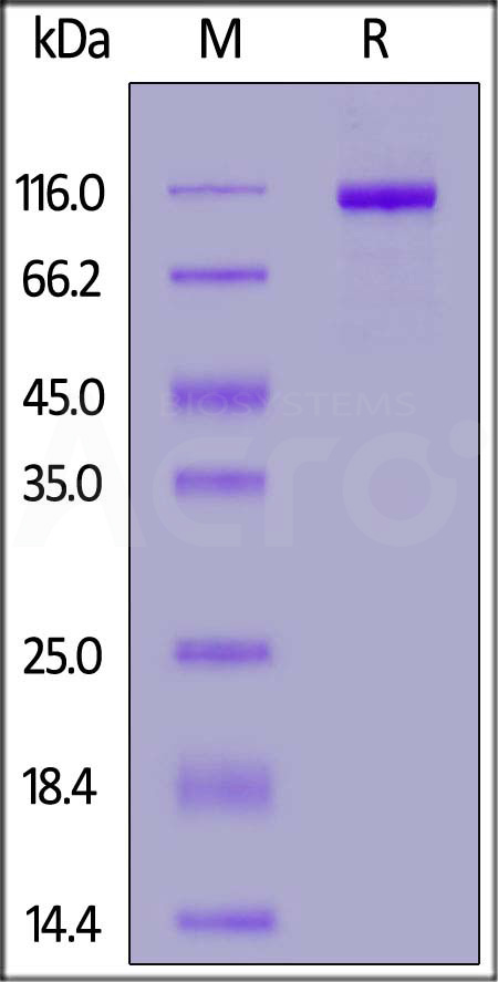 ENPP3 SDS-PAGE