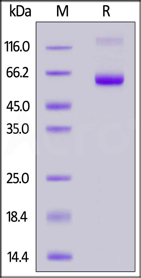 FITC-Labeled Human EpCAM, Fc Tag (Cat. No. EPM-HF255) SDS-PAGE gel