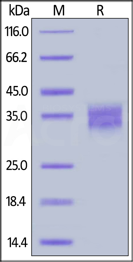 Fc gamma RIV / CD16-2 SDS-PAGE