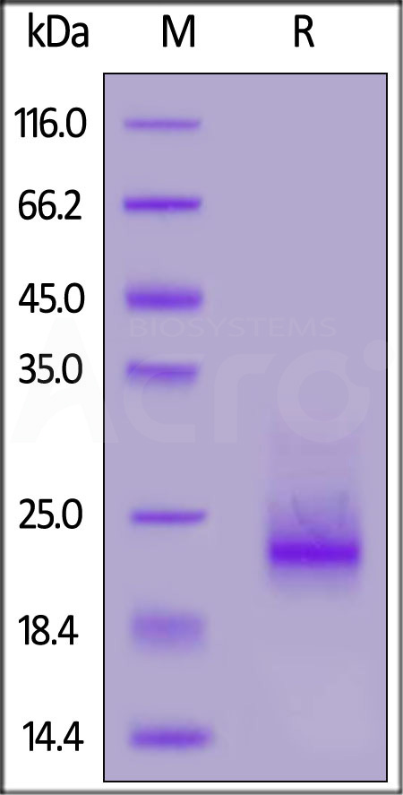 Human Frizzled-10, His Tag (Cat. No. FRD-H52H3) SDS-PAGE gel