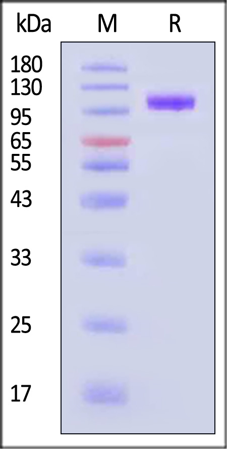 Glycoprotein B (EBV) SDS-PAGE