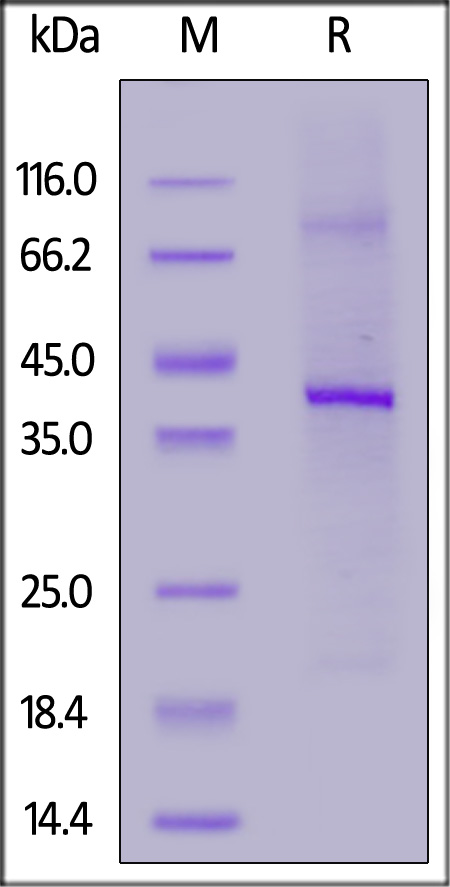 GPRC5D SDS-PAGE