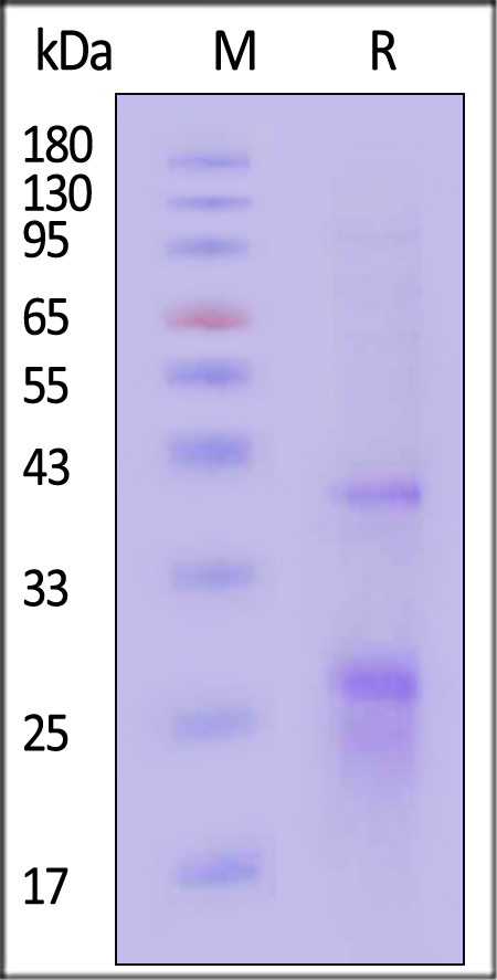 GPRC5D SDS-PAGE