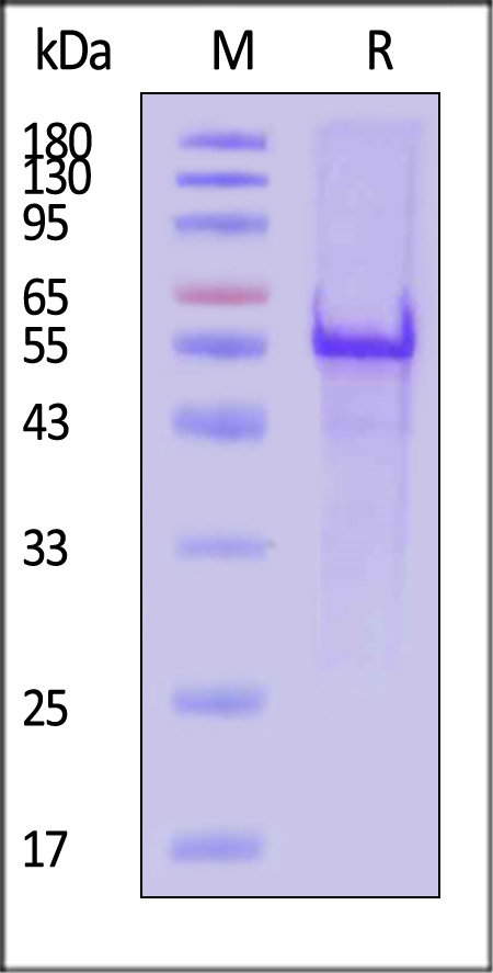 GPT SDS-PAGE