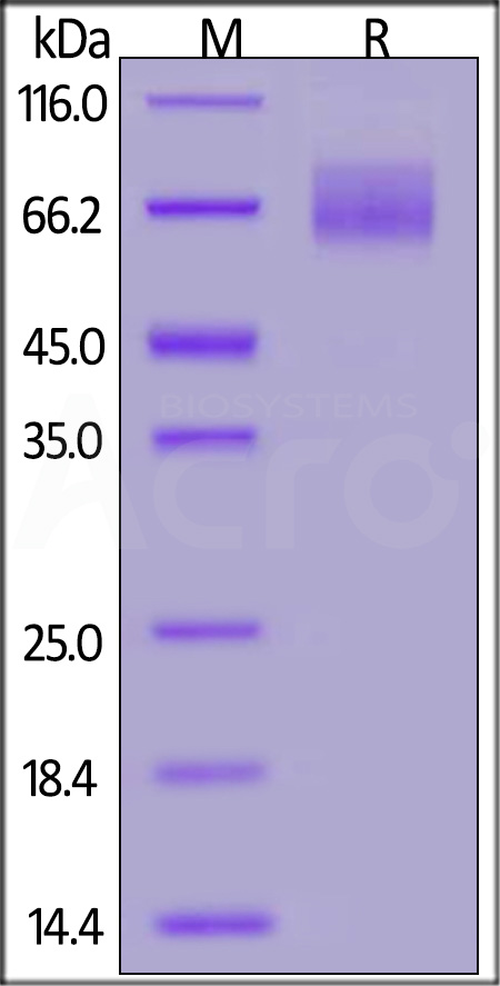 GUCY2C SDS-PAGE