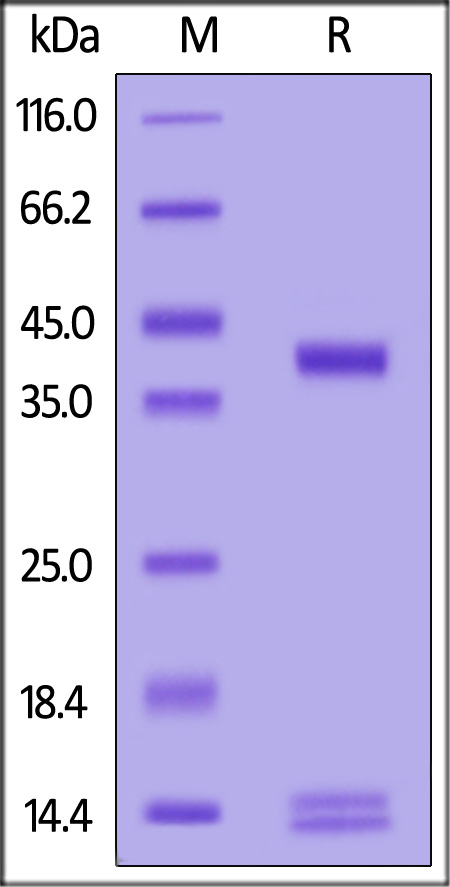 HLA-A*02:01 & B2M & NY-ESO-1 SDS-PAGE