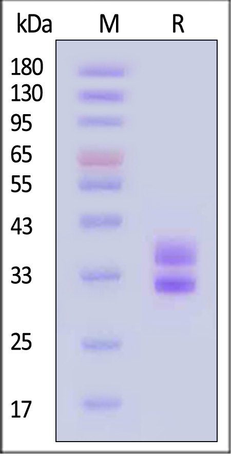 HLA-DRA1*0101 & HLA-DRB1*0401 SDS-PAGE