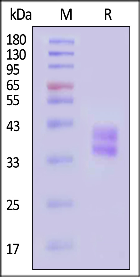 HLA-DRA1*0101 & HLA-DRB1*1101 SDS-PAGE