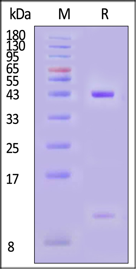 HLA-A*0201 & B2M & HPV16-E7 SDS-PAGE