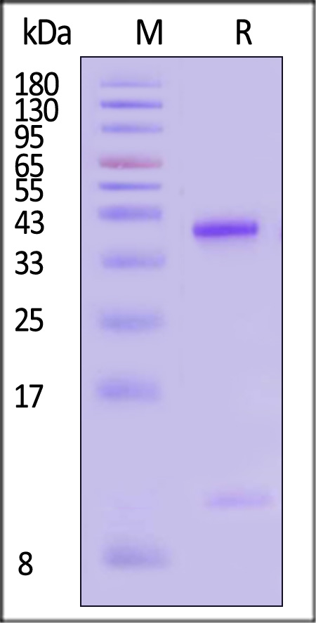 HLA-A*1101 & B2M & KRASG12D (VVVGADGVGK) SDS-PAGE