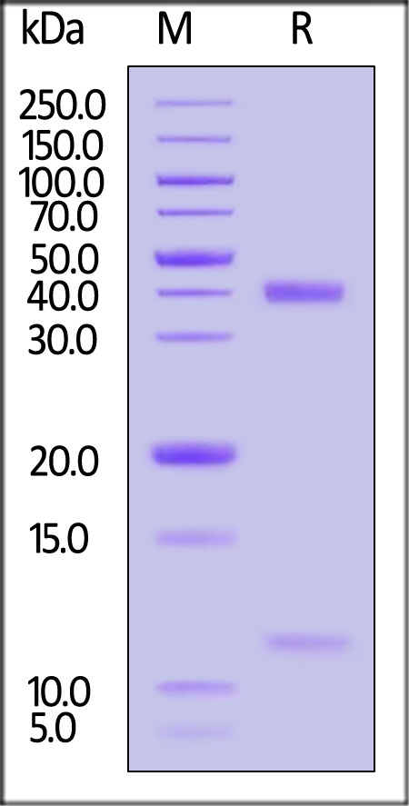 HLA-A*1101 | B2M | KRASG12D (VVGADGVGK) SDS-PAGE