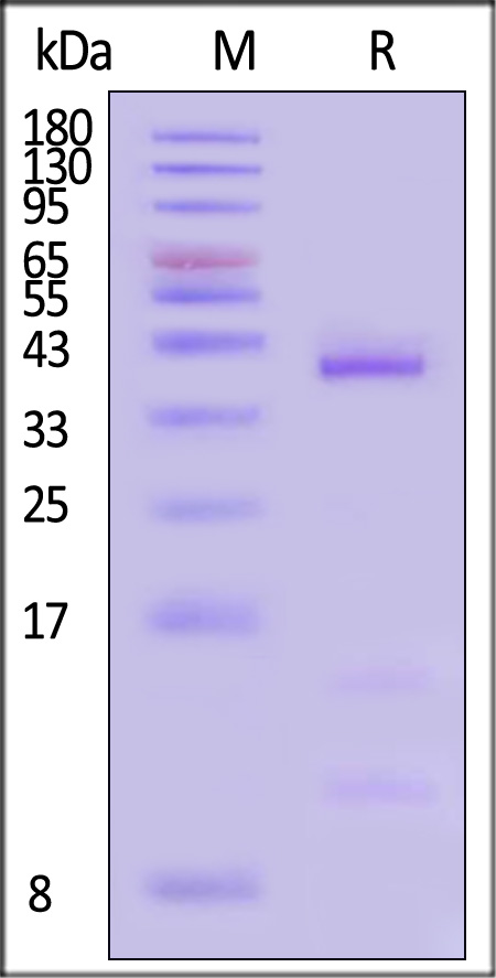 HLA-A*1101 & B2M & KRASG12D (VVVGADGVGK) SDS-PAGE