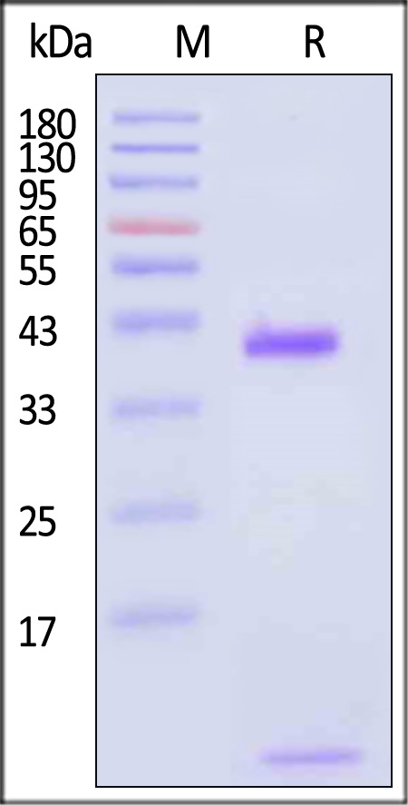 HLA-A*0201 & B2M & KRASG12D (KLVVVGADGV) SDS-PAGE